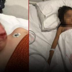 Ankara'da 2 kardeş pitbull saldırısına uğramıştı! Yeni gelişme 