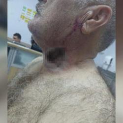 Yere d&uuml;ş&uuml;rd&uuml;, &uuml;st&uuml;nde tepindi: At, sahibini boğazından ısırdı!