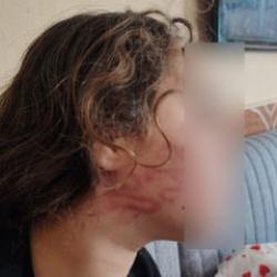 Adana'da 11 yaşındaki &ccedil;ocuğa darp iddiası! Allah i&ccedil;in yapma dedim