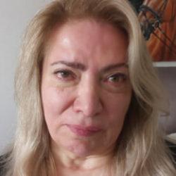 Ankara'da estetik kabusu: Y&uuml;z felci ge&ccedil;irdiğini iddia etti 
