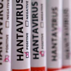 Herkesin aklında tek soru! Hantavir&uuml;s insandan insana bulaşır mı?