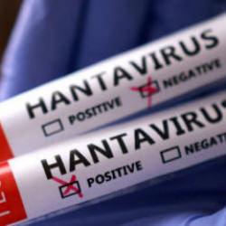 İngiltere'de yeni hantavir&uuml;s vakası!
