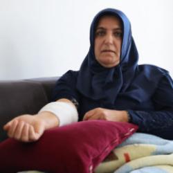 Elazığ'da k&ouml;pek saldırısına uğrayan kadın: Beni parampar&ccedil;a ederdi 
