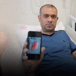 Sırtındaki şişliği &ouml;nemsemedi! Yıllar i&ccedil;inde b&uuml;y&uuml;d&uuml;! Doktorları şoke eden vaka