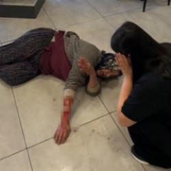 Afyonkarahisar'da k&ouml;pek dehşeti! S&uuml;r&uuml;klediği kadının kolunu kopardı