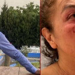 Yalanla ayağına &ccedil;ağırdı &ouml;ld&uuml;resiye d&ouml;vd&uuml;! Saldırgan belediye &ccedil;alışanı &ccedil;ıktı
