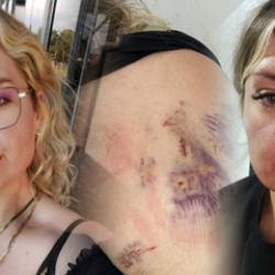 15 dakika boyunca bı&ccedil;aklanan &Ouml;zge: Bı&ccedil;ak kırılmasaydı zaten yaşama şansım yoktu