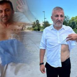V&uuml;cudundaki kurşunla 10 yıldır yaşayan 15 Temmuz Gazisi Musa İlhan o geceyi anlattı 