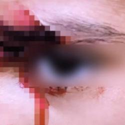 Şanlıurfa'da k&ouml;pek dehşeti! 8 yaşındaki &ccedil;ocuk kanlar i&ccedil;inde kaldı 