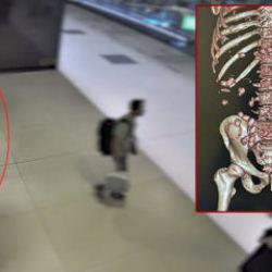 Y&uuml;r&uuml;mekte zorlanınca yakayı ele verdi! Midesinde tam 26 kaps&uuml;l uyuşturucu &ccedil;ıktı!