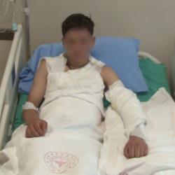 Merakı başına iş aştı! V&uuml;cudunun y&uuml;zde 25'i yandı... Hemen hemen her evde var