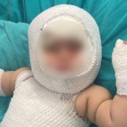 Mersin'de konserve faciası! 9 aylık bebek yandı 