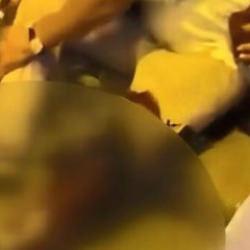 K&ouml;peğine saldıran, pitbull cinsi k&ouml;peğin sahibini 3 yerinden bı&ccedil;akladı 