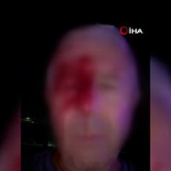 Haber yaparken saldırıya uğrayan muhabir yaralandı