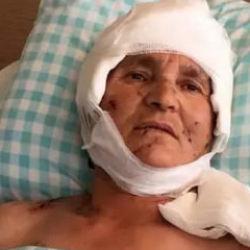 Kırşehir'de k&ouml;pek saldırısına uğrayan 63 yaşındaki kadına tazminat &ouml;denecek