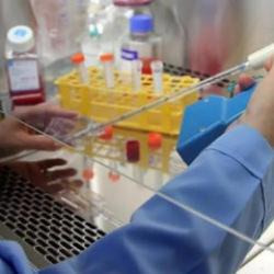G&ouml;ky&uuml;z&uuml;ndeki gizli tehlike: Kanser riski en y&uuml;ksek meslekler belli oldu