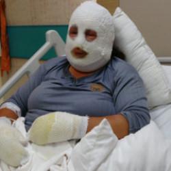 Ardahan'da evladı i&ccedil;in alevlerin arasına giren anne yandı 