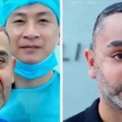 58 yaşında gen&ccedil;leşmek istedi, Vietnam'a gitti! T&uuml;rk uzmandan olay estetik yorumu