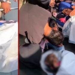 Yaralı kadından eşe son bakış! D&uuml;nya bu bakışı konuşuyor...