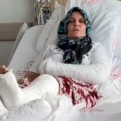 Mersin'de saldırı! 3 &ccedil;ocuk annesinin kolu ve bacağı kırıldı: 4 tutuklu 
