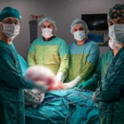 Karın ağrısıyla doktora gitti ger&ccedil;eği g&ouml;r&uuml;nce şaşkına d&ouml;nd&uuml;! Tam 15 kg &ccedil;ıkarıldı...
