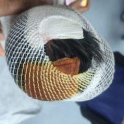 Şanlıurfa'da k&ouml;pek s&uuml;r&uuml;s&uuml; dehşeti! &Ccedil;ocuk kan revan i&ccedil;inde kaldı