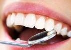 Kanal tedavisi dişlerin ömrünü uzatıyor