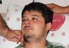 MHP'lilerin dövdüğü AK Partili genç konuştu