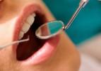 Oruçlu kimse diş tedavisi yaptırabilir mi?