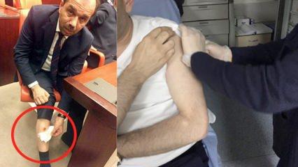 Bacağından ısırılan AK Partili vekil öyle bir fotoğraf paylaştı ki
