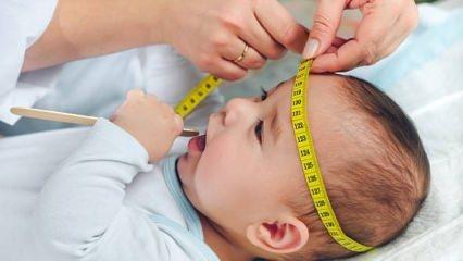 Bebeğinizin baş çevresini mutlaka ölçtürün!
