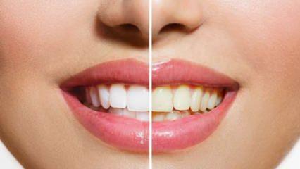 Doğal, etkili ve kalıcı diş beyazlatma yöntemleri! Bembeyaz dişler...