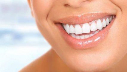 Dişler doğal yöntemlerle en kolay nasıl beyazlar?