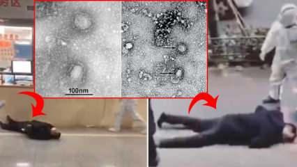 Cesetler sokaklarda! Coronavirüsün mikroskobik ilk görüntüleri yayınlandı