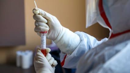 Koronavirüsle ilgili dikkati çeken sözler: Aşısının bulunması daha tehlikeli