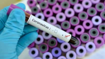 Dünyanın beklediği 'koronavirüs aşısı' haberi geldi: Denemeye başladık