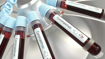 Herkes merak ediyordu! Türkiye'de kaç kişiye koronavirüs testi yapıldı?