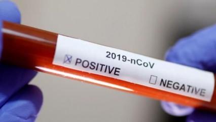 KKTC'de koronavirüs bulaşanların sayısı 6'ya yükseldi