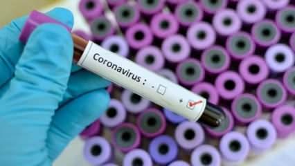 Özel sağlık sigortası poliçeleri corona virüs tedavi giderlerini kapsıyor mu?