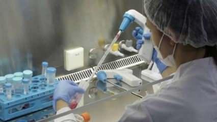 Türk uzman açıkladı: Koronavirüs tedavisinde kök hücre umudu