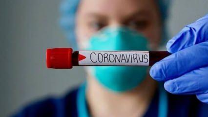 Corona Virüs testi yapan hastaneler hangileri?