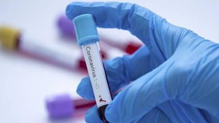 ilçe sağlık müdürünün koronavirüs testi pozitif çıktı