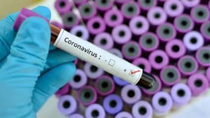 2015'te ilk KKKA aşısını bulan Türk doktordan büyük başarı: Koronavirüsü izole etti