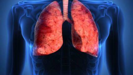 Akciğer kanserinin belirtileri nelerdir? Akciğer kanseri tedavisi nasıl olur?