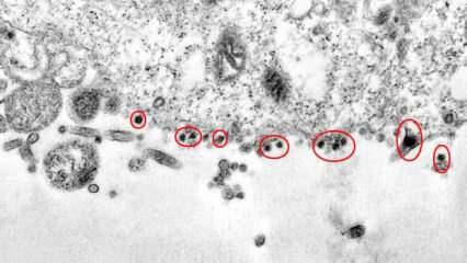 Koronavirüsün hücreye saldırı anı ilk kez görüntülendi