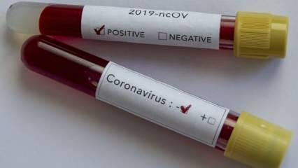 Türkiye'de koronavirüste müthiş gelişme! Birçok hastalığı vardı testleri negatife döndü