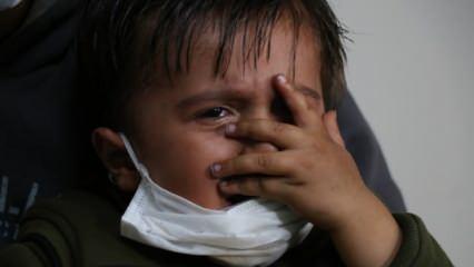 2 yaşındaki Abdurrahman’ın umudu koronavirüs engeline takıldı