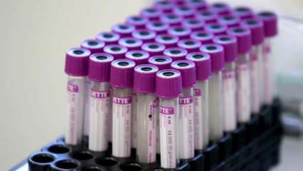 NY Times duyurdu: FDA koronavirüs için ilk ilacı onaylıyor