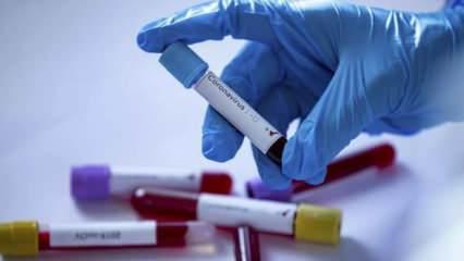 Madagaskar'dan koronavirüs ilacı iddiası