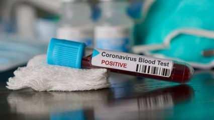 Üşüttüm diyene koronavirüs testi yapılacak!